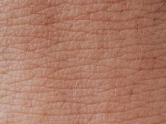 Cilt Hastalıkları: Yağlı Egzama ve Tedavi Yöntemleri cildiye1